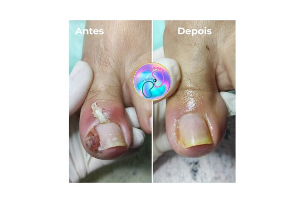 Foto de antes e depois do tratamento 29